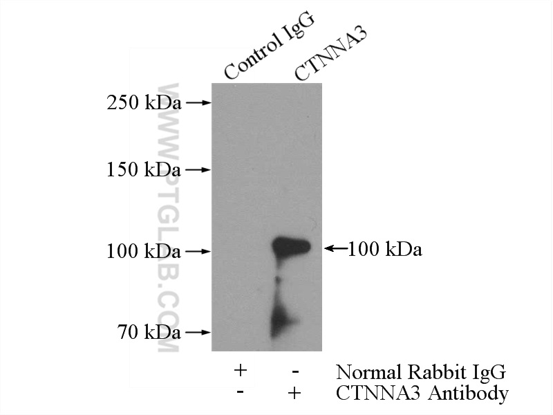 IP experiment of mouse testis using 13974-1-AP