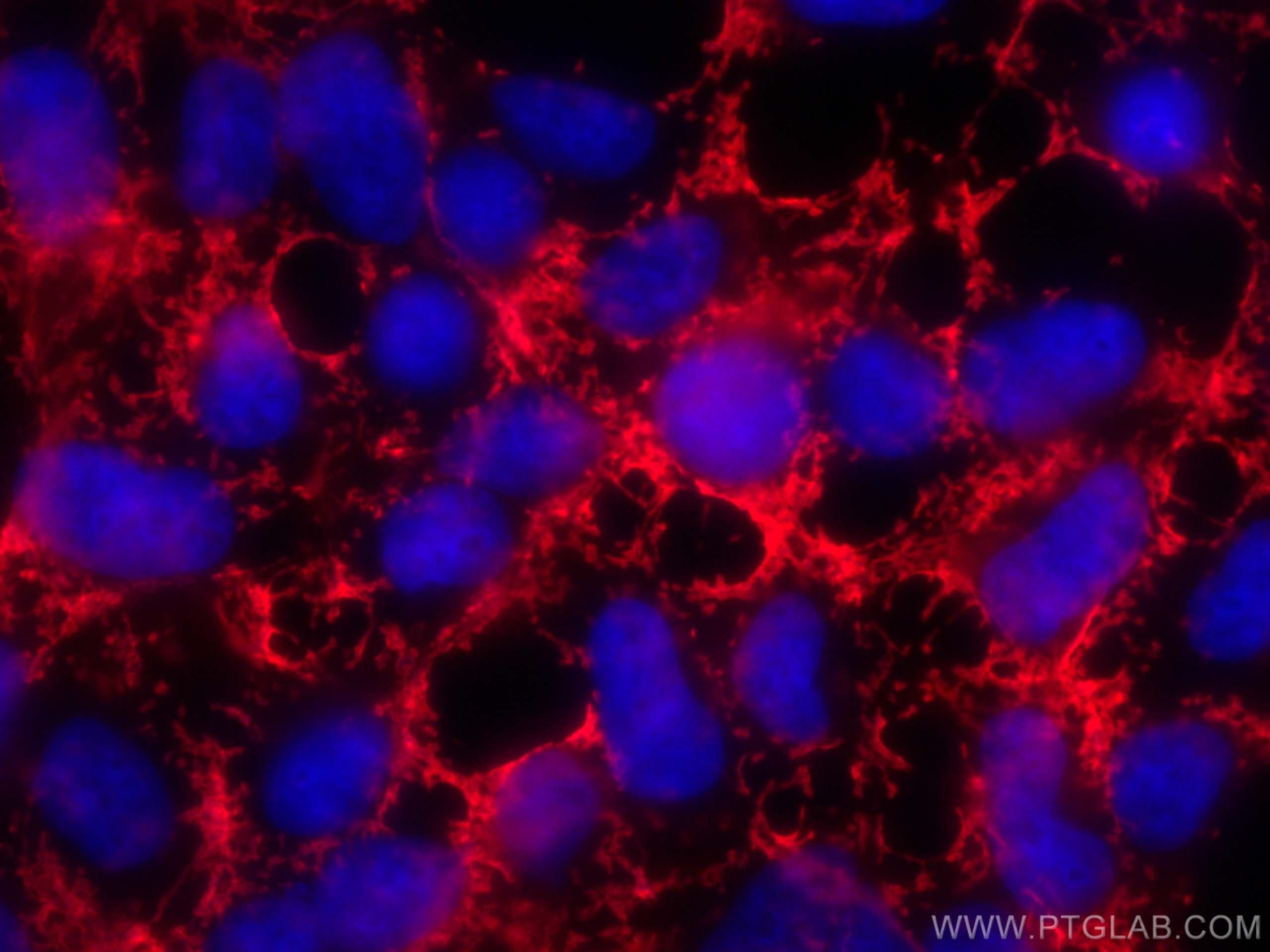 IF Staining of HEK-293 using 13085-1-AP