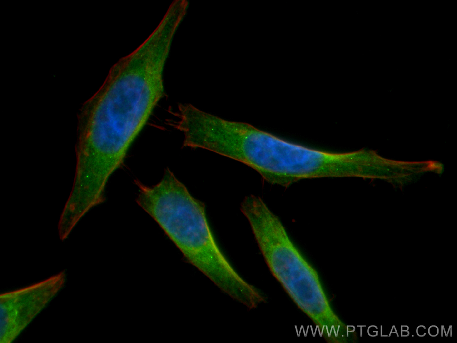 IF Staining of HepG2 using 15914-1-AP