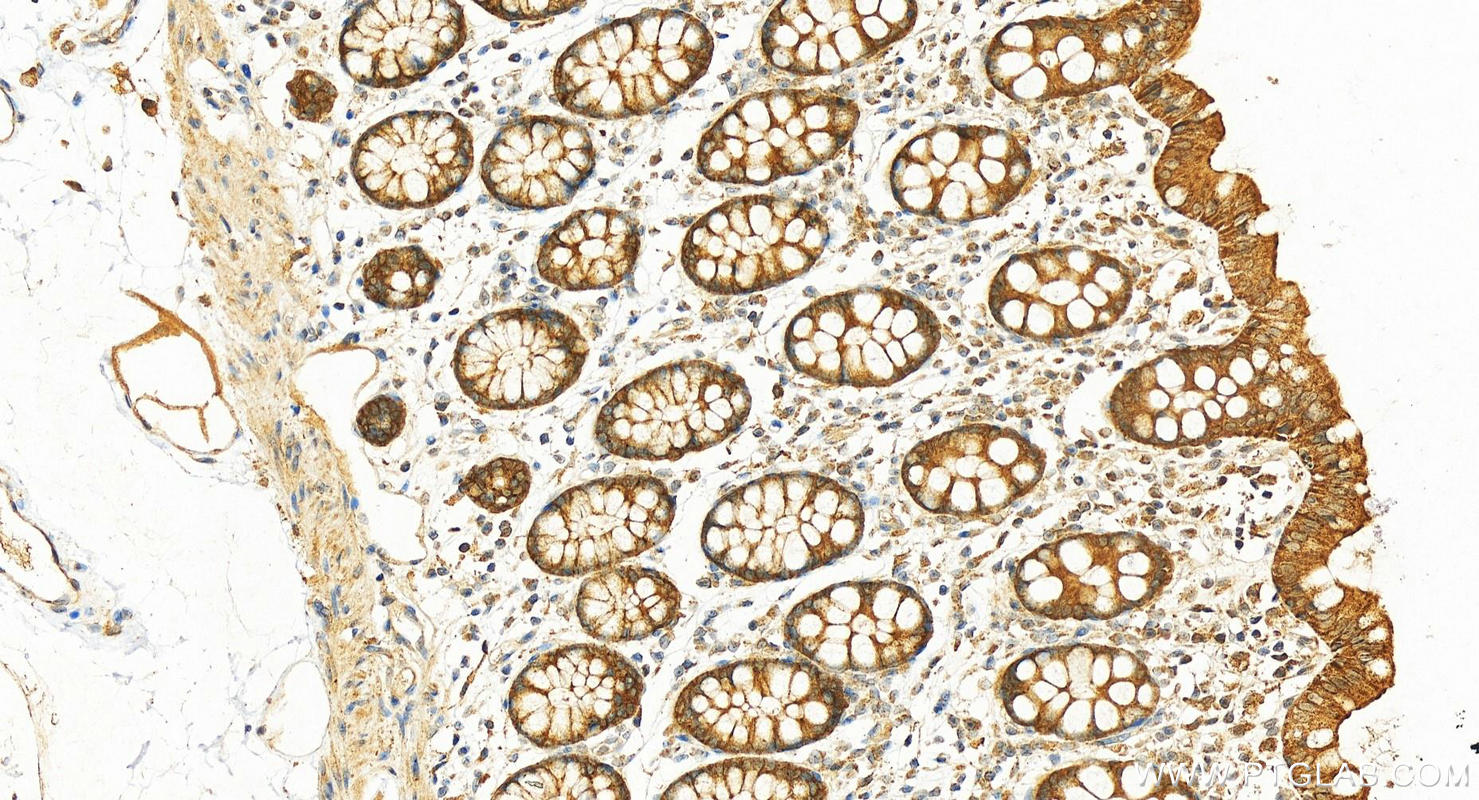 IHC staining of human colon using 12852-1-AP