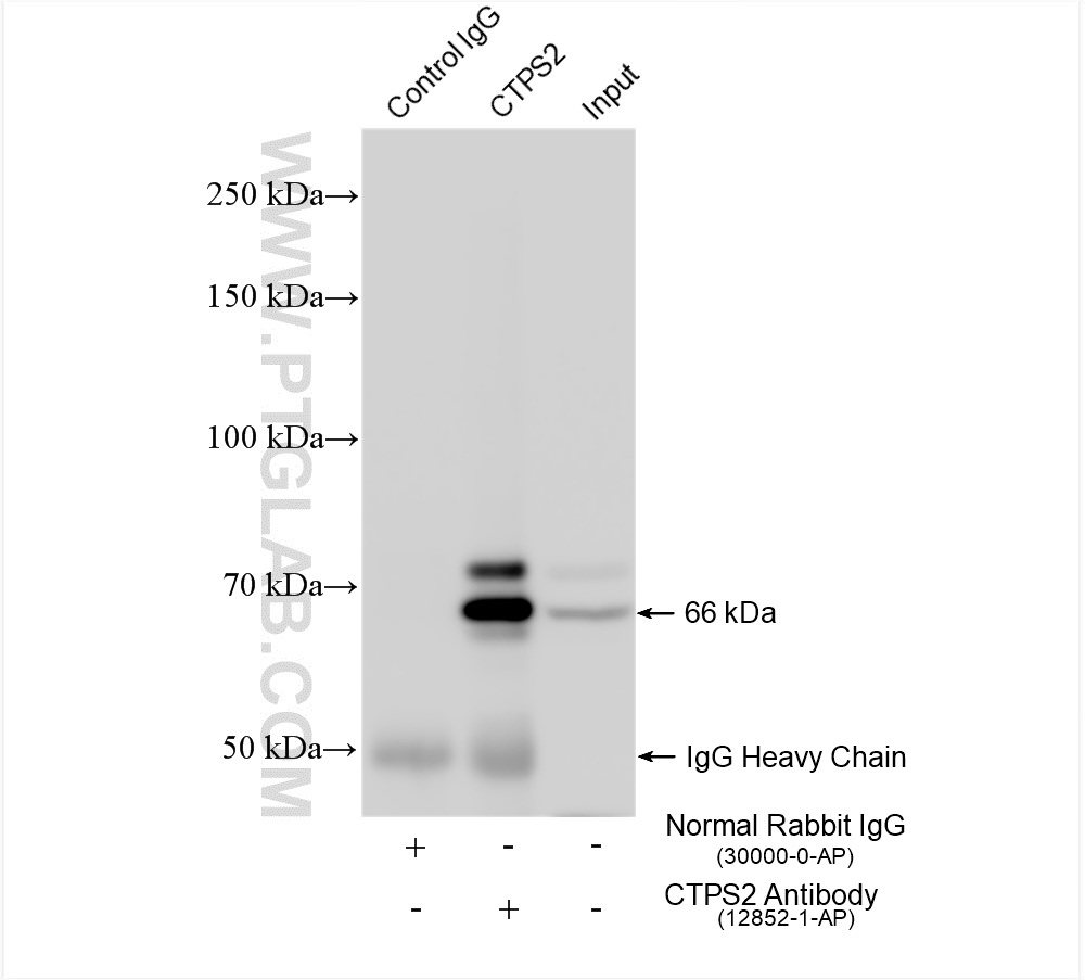 IP experiment of HeLa using 12852-1-AP