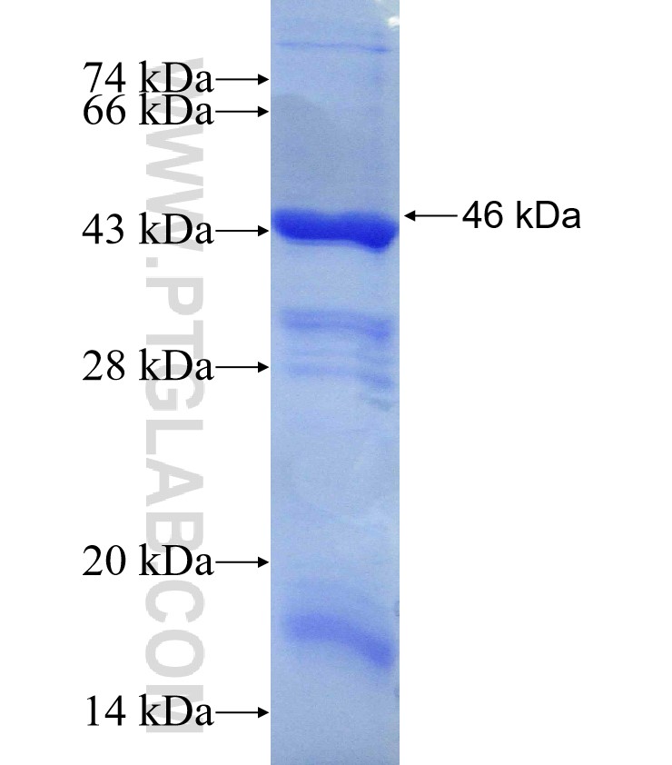 CTPS2 fusion protein Ag30258 SDS-PAGE