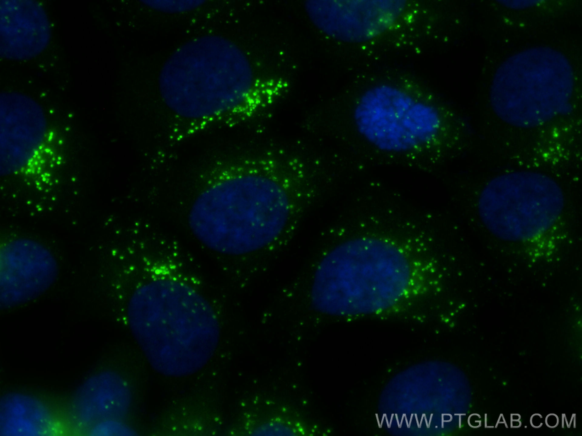 IF Staining of MCF-7 using 21327-1-AP