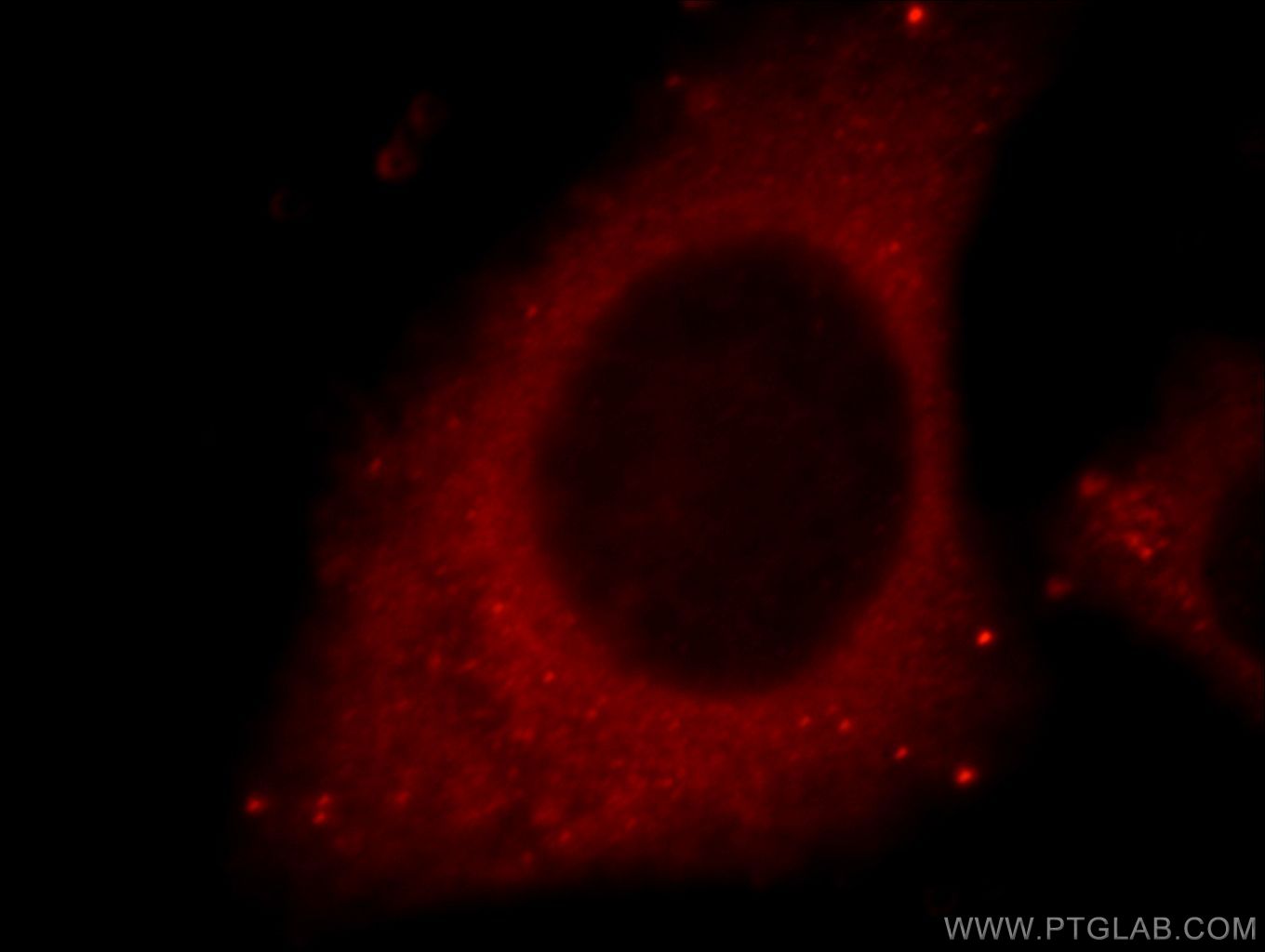 Cathepsin D