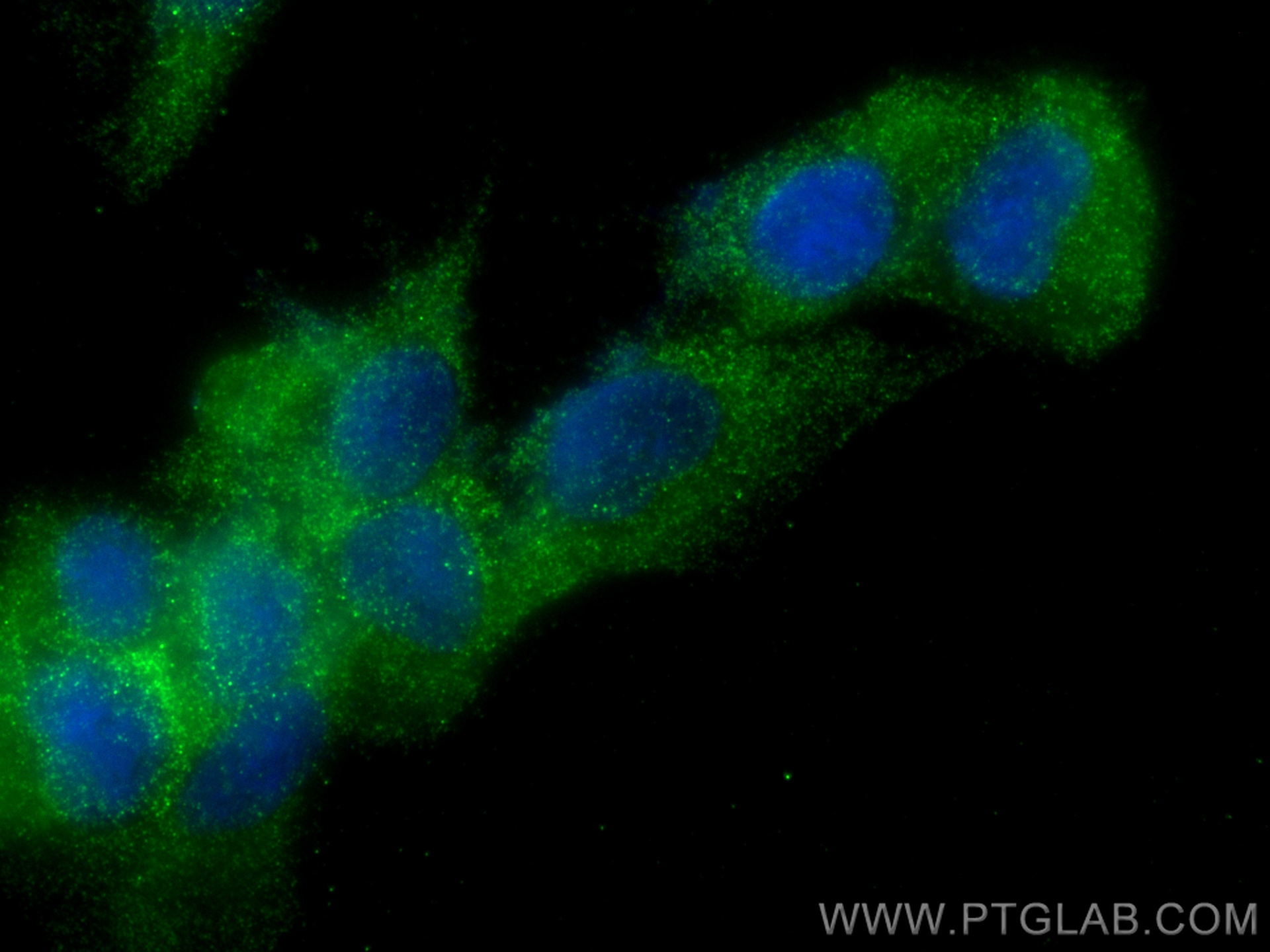 IF Staining of ROS1728 using 11239-1-AP