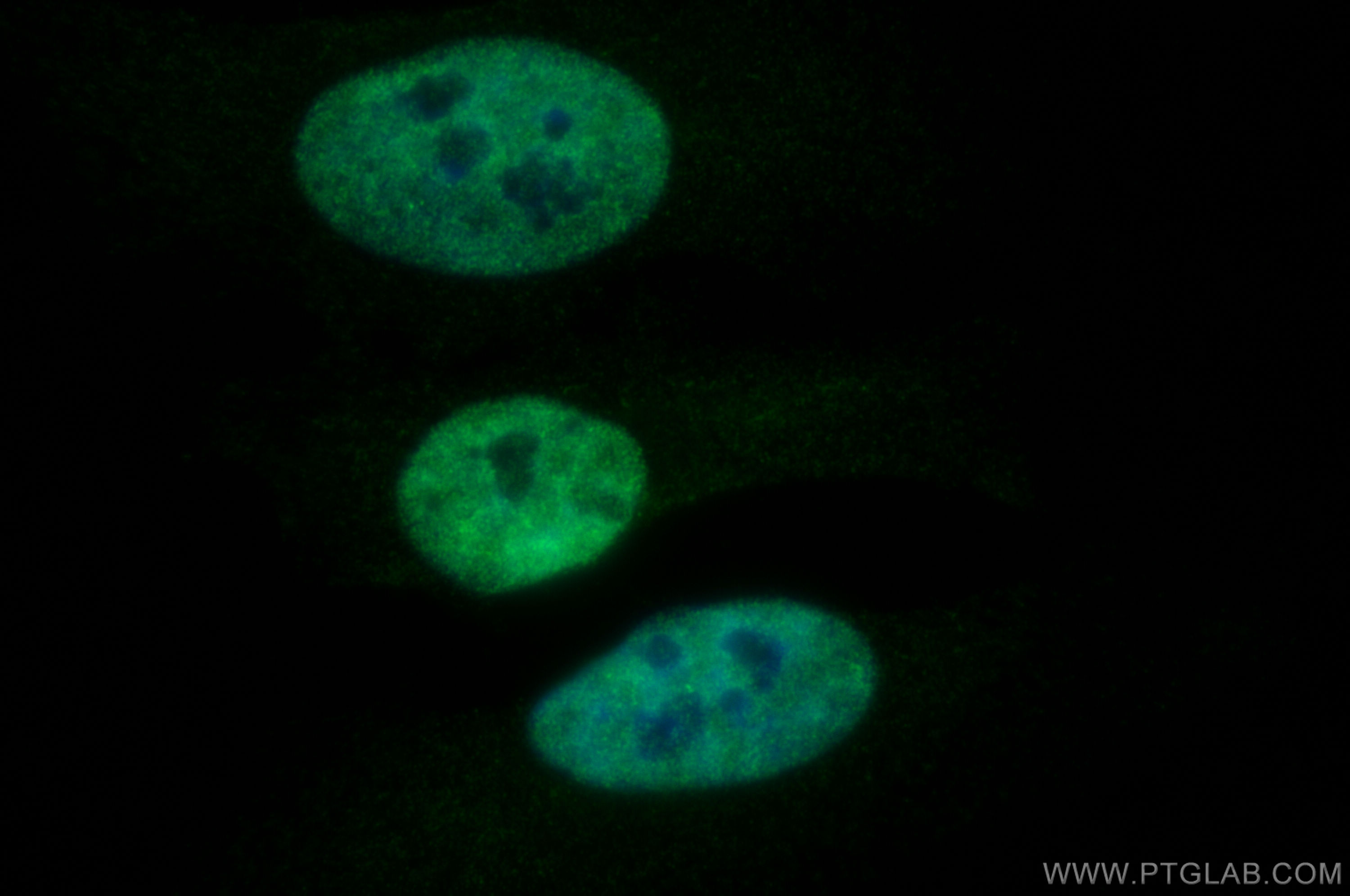 IF Staining of HeLa using 13002-1-AP