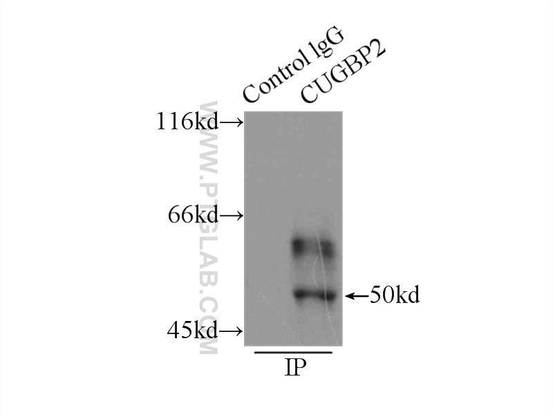 IP experiment of mouse skeletal muscle using 12921-1-AP