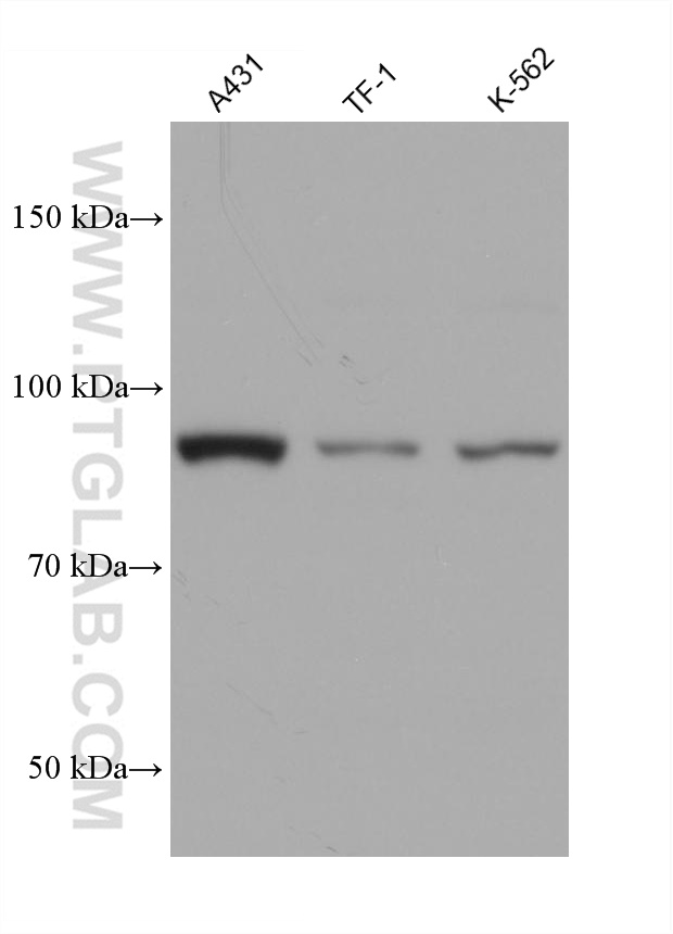 WB analysis using 67175-1-Ig