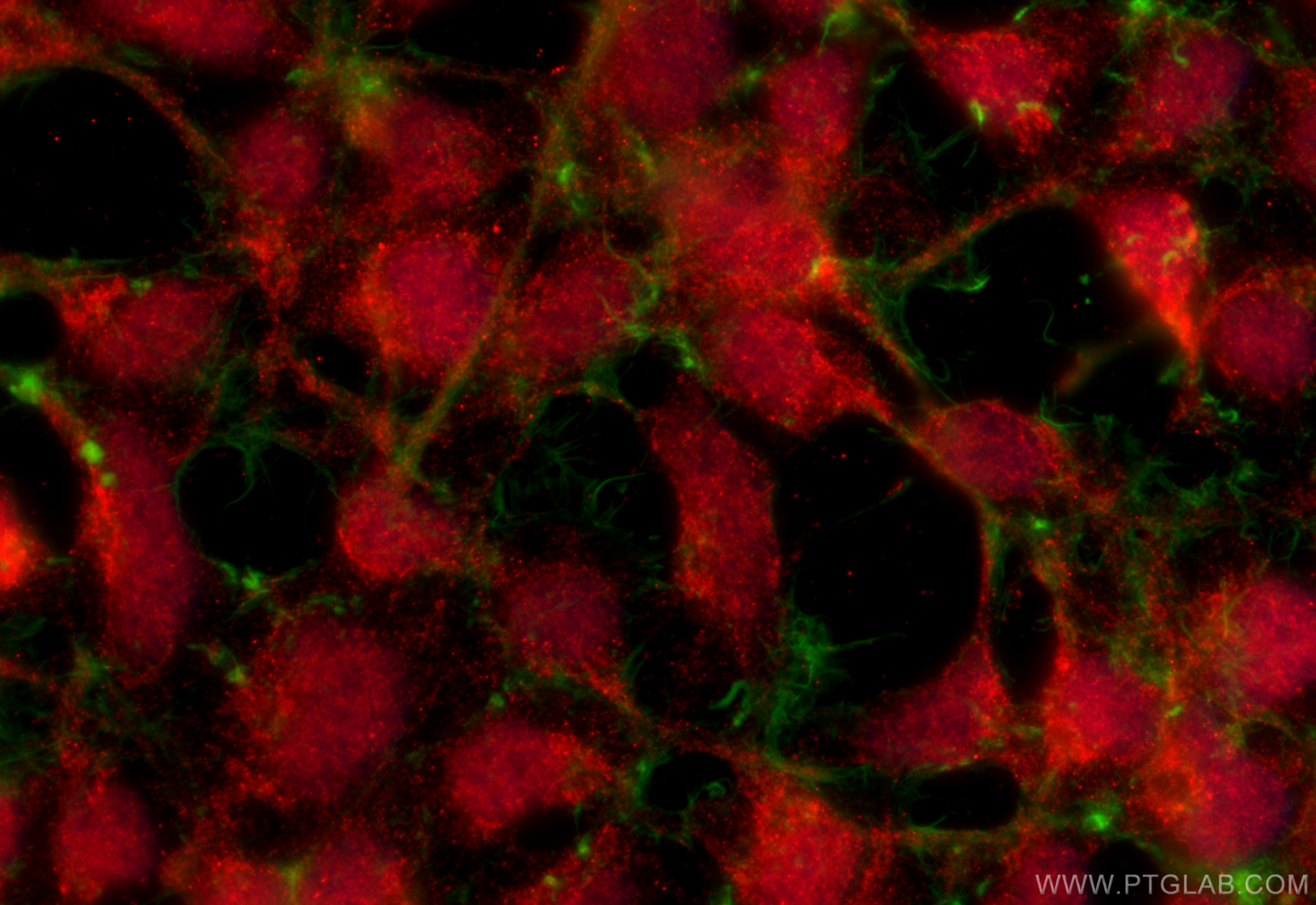 IF Staining of HEK-293 using 11107-1-AP