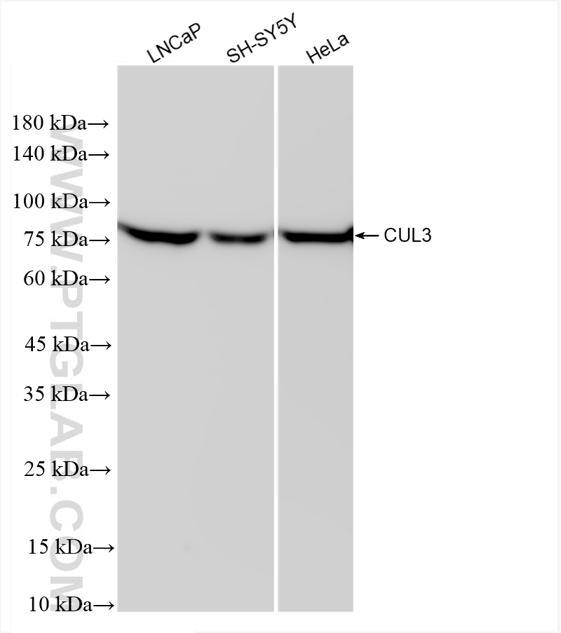 WB analysis using 83619-5-RR (same clone as 83619-5-PBS)