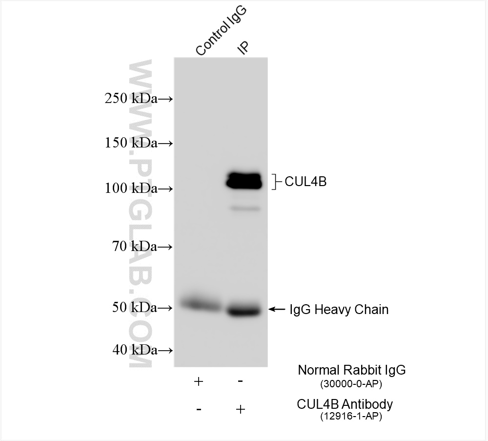 IP experiment of HeLa using 12916-1-AP