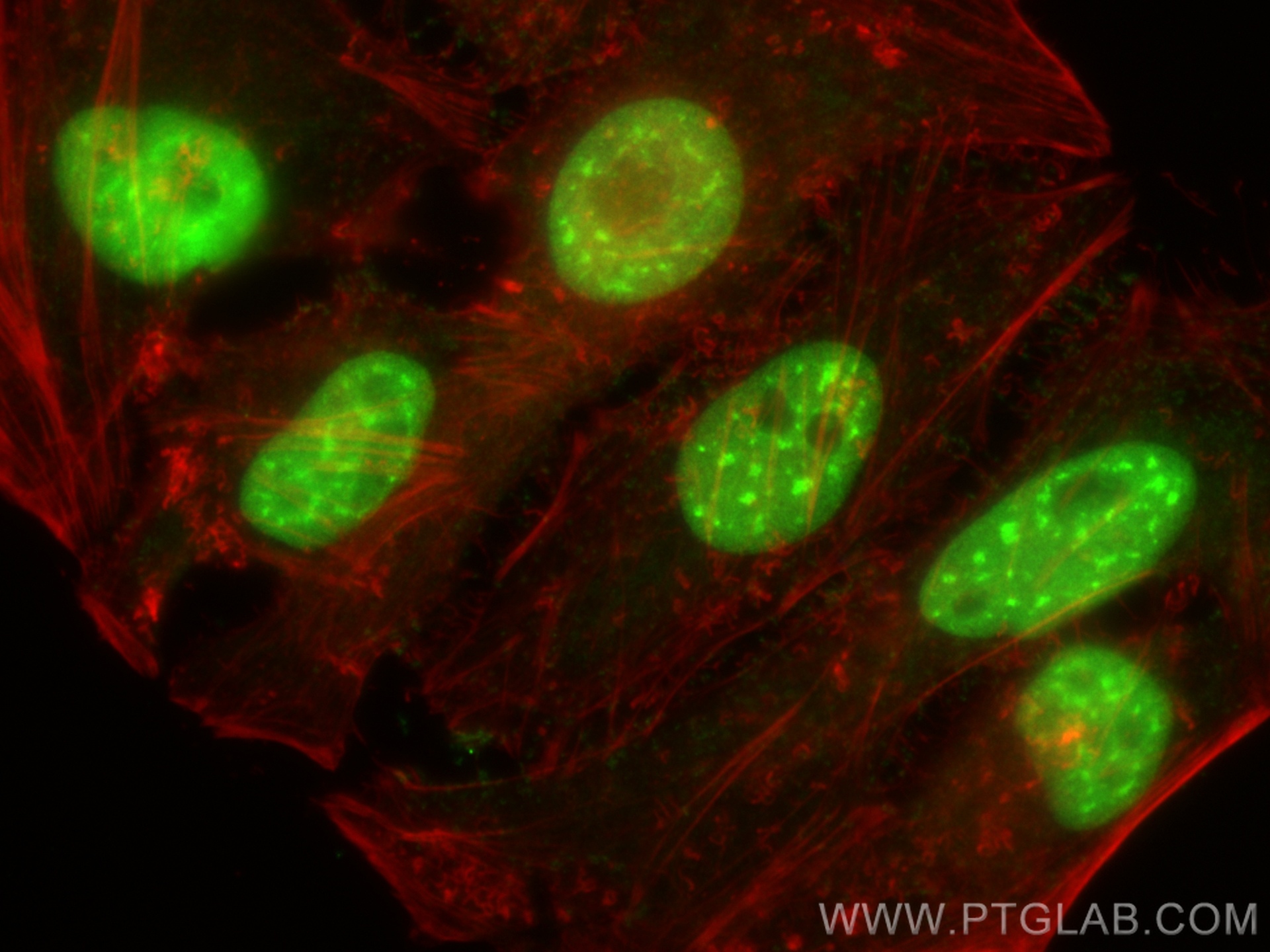 IF Staining of HeLa using 20882-1-AP