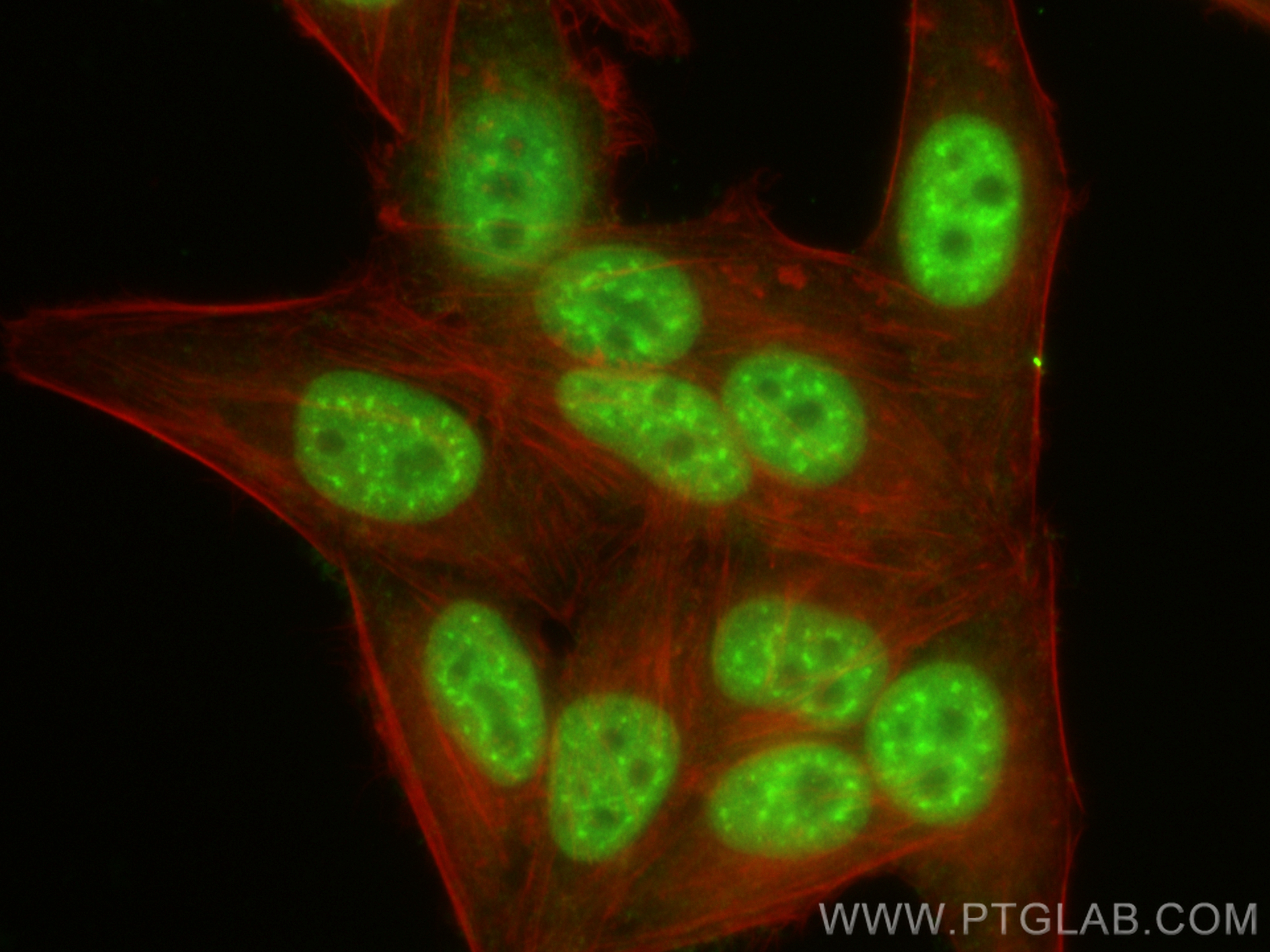 IF Staining of HepG2 using 20882-1-AP