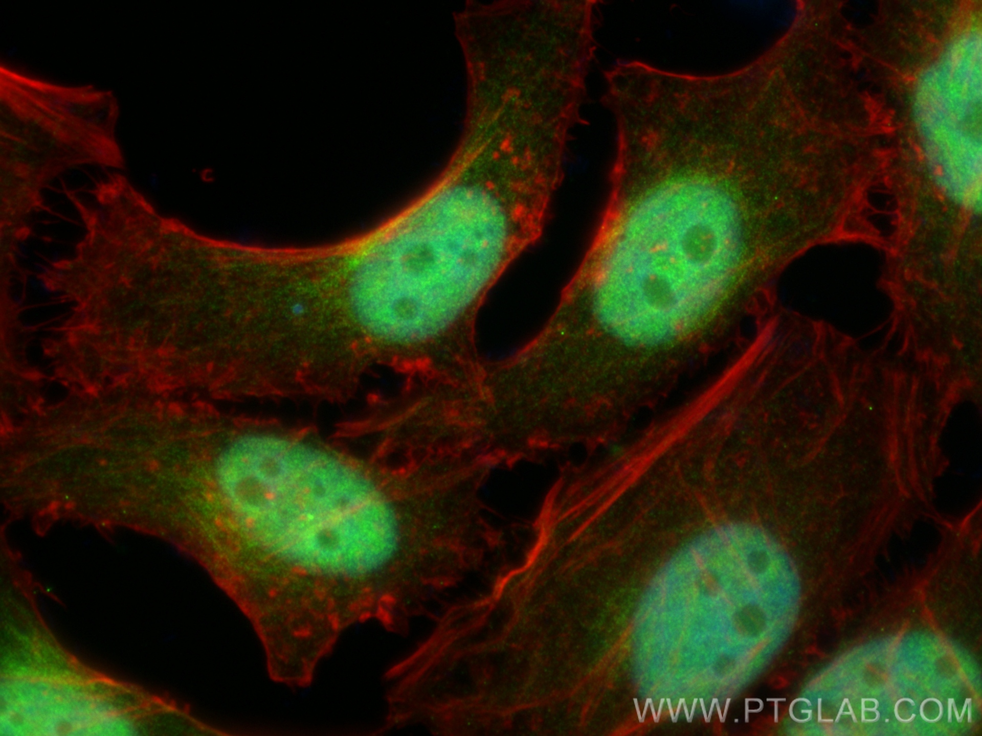 IF Staining of HeLa using 15030-1-AP