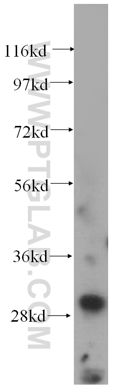 WB analysis of HeLa using 15030-1-AP