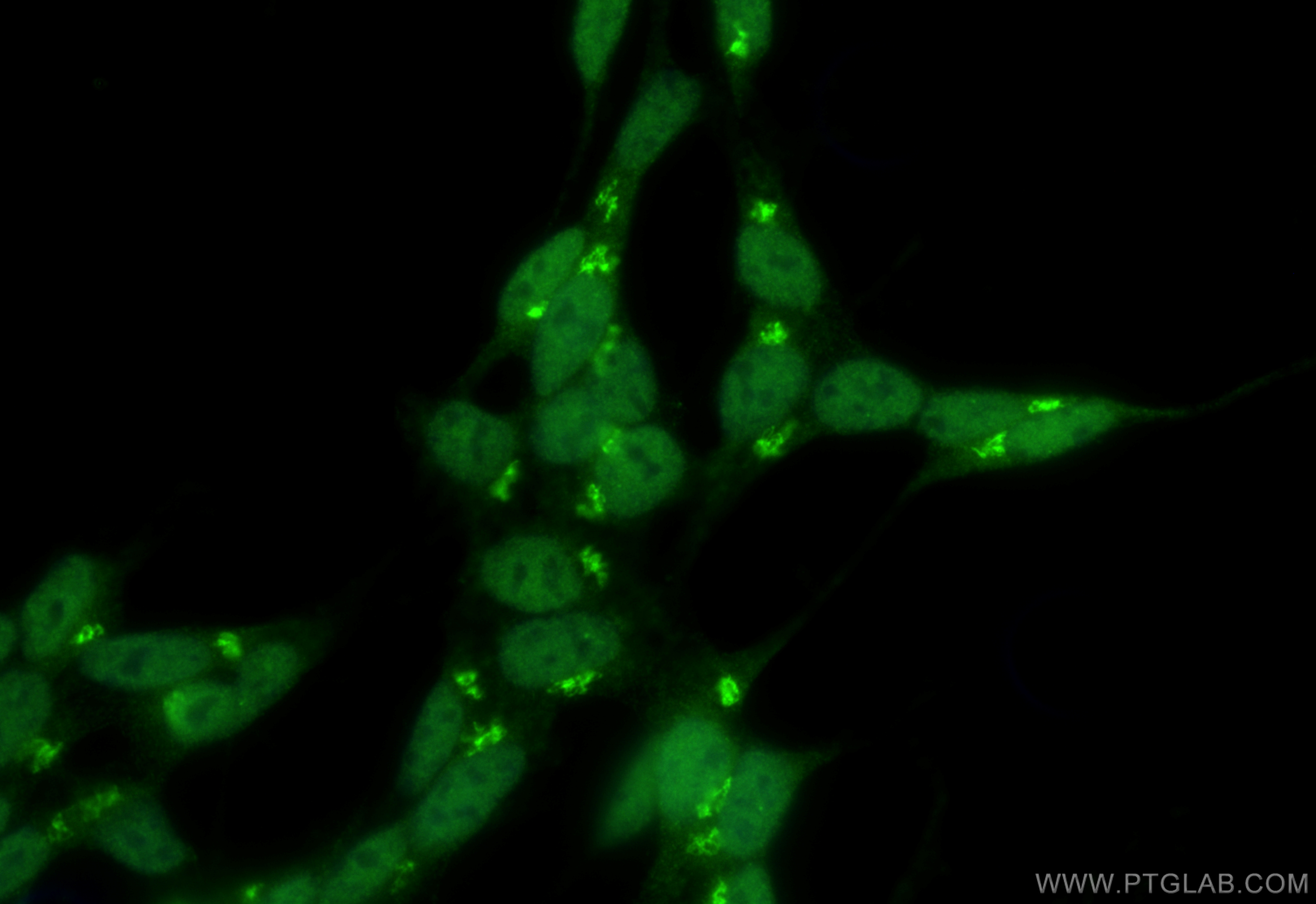 IF Staining of SH-SY5Y using 11733-1-AP