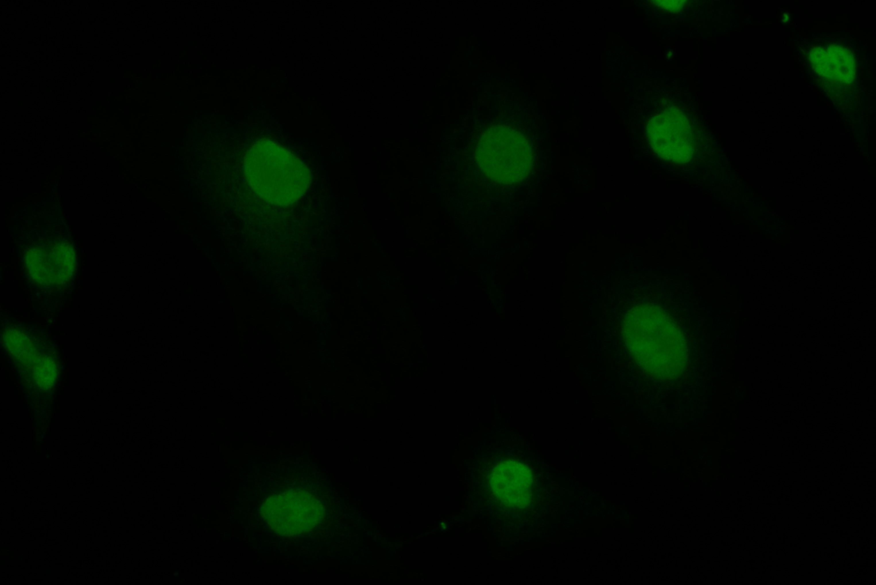 IF Staining of HeLa using 82933-1-RR