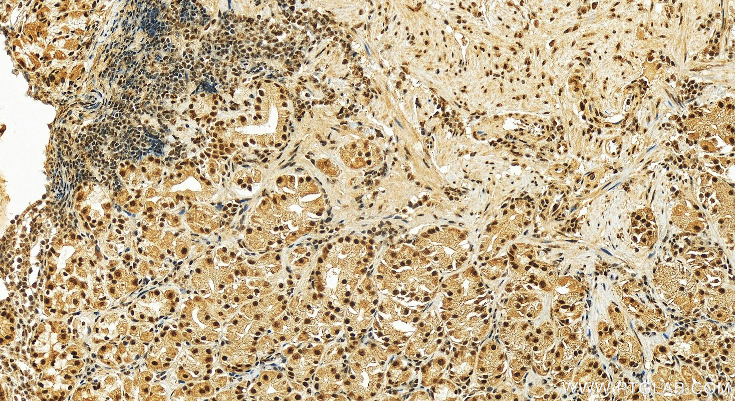 IHC staining of human stomach using 25293-1-AP