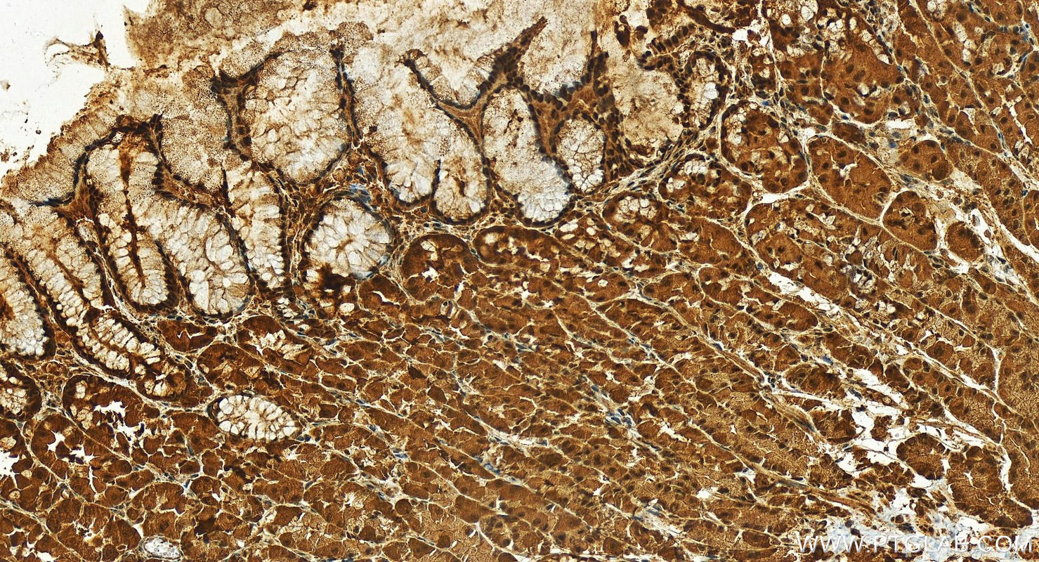 IHC staining of human stomach using 26898-1-AP