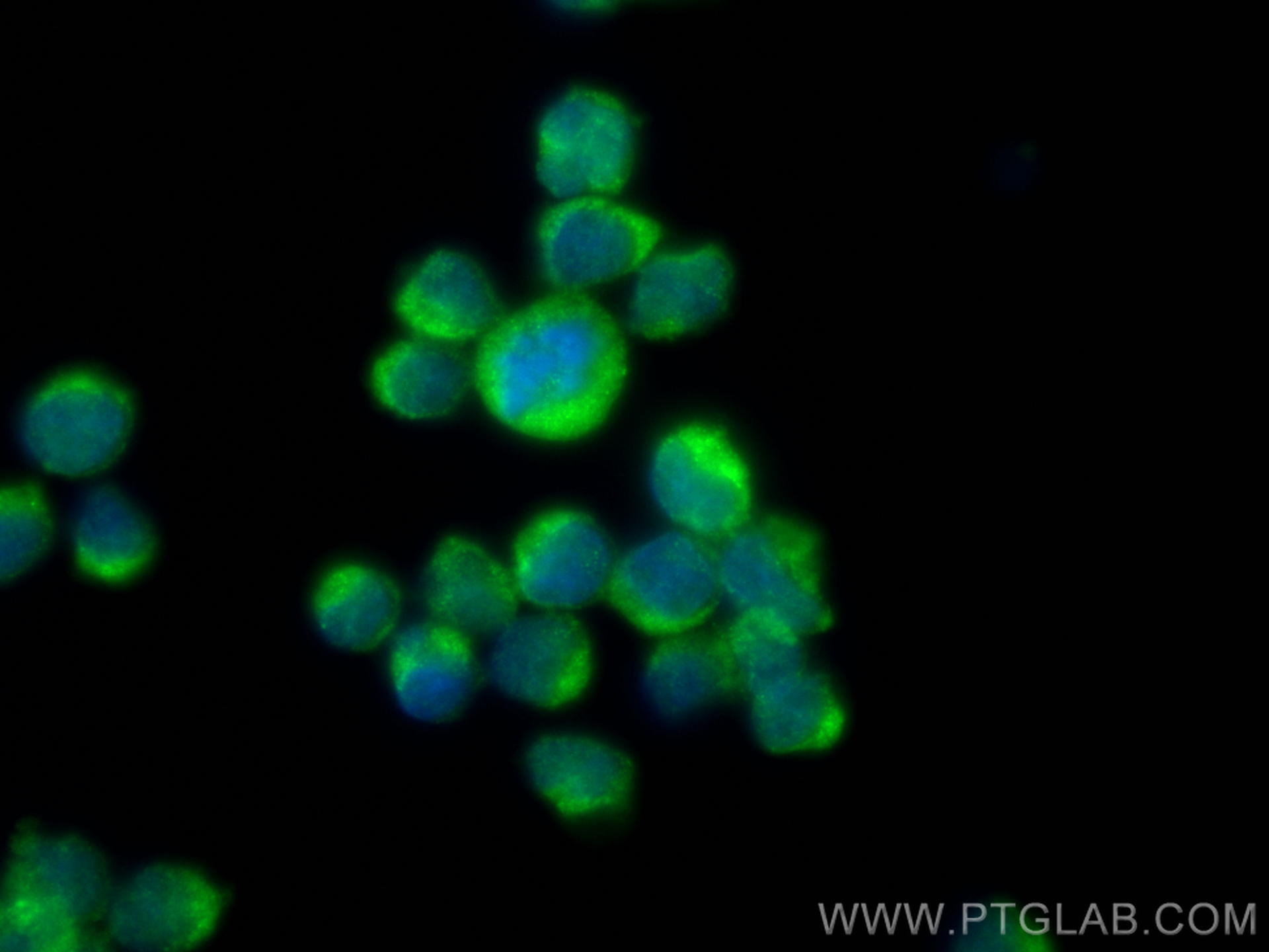 IF Staining of Jurkat using 17402-1-AP