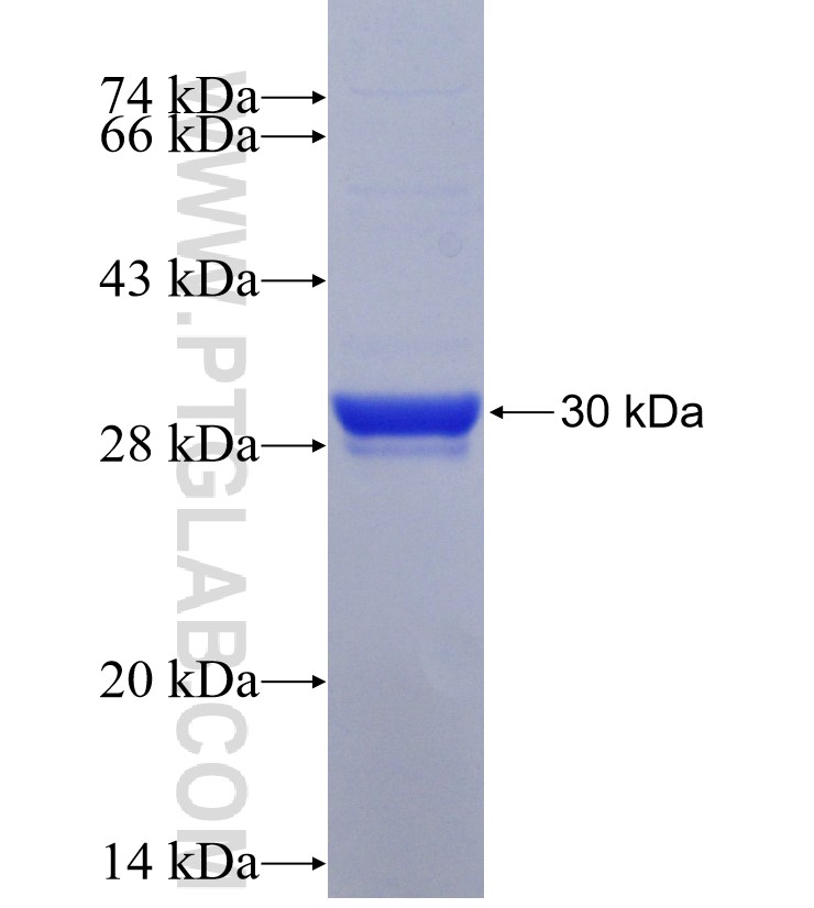CXCL16 fusion protein Ag30981 SDS-PAGE