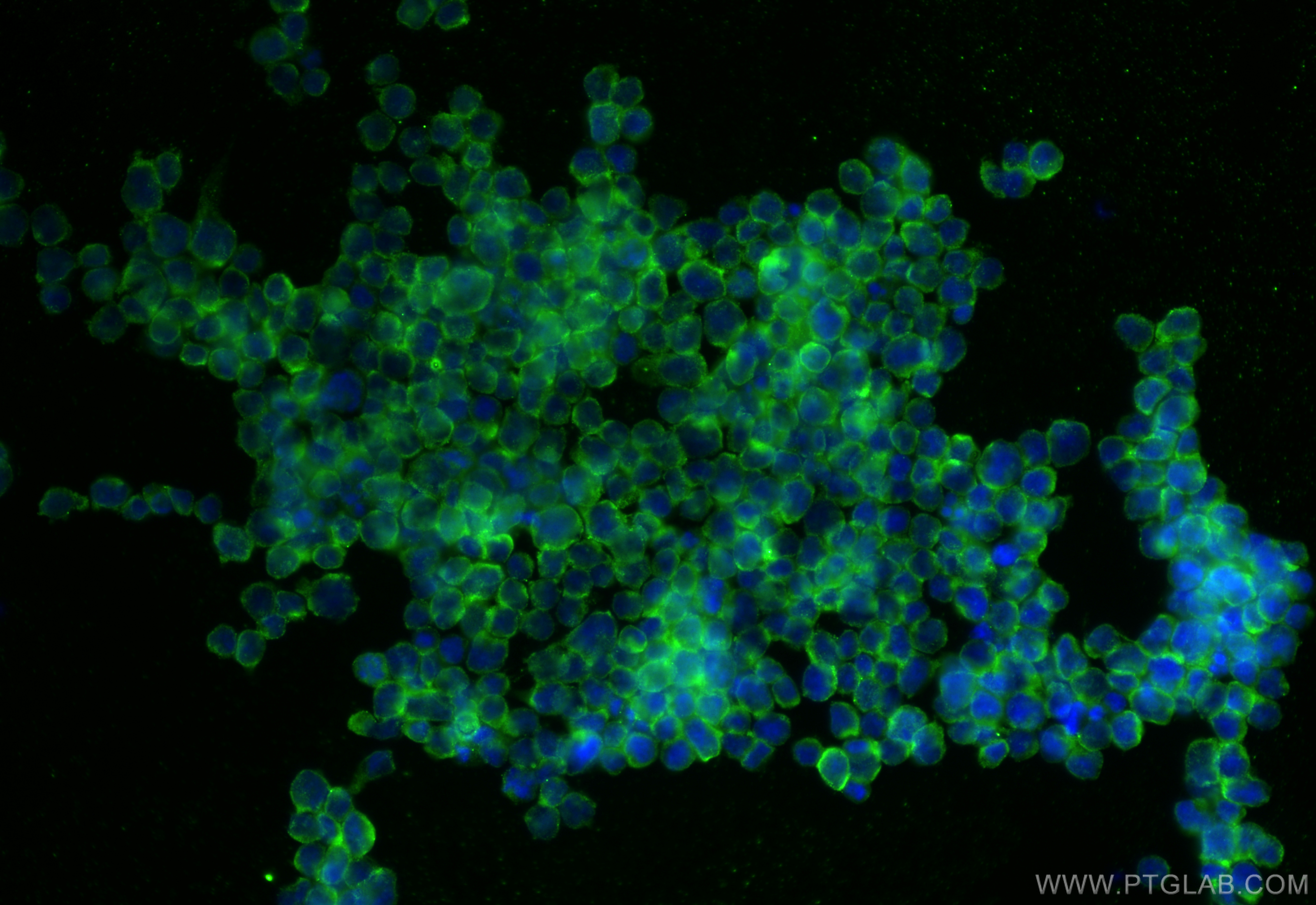 IF Staining of Jurkat using 55450-1-AP