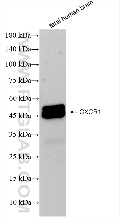 WB analysis of fetal human brain using 83801-4-RR (same clone as 83801-4-PBS)