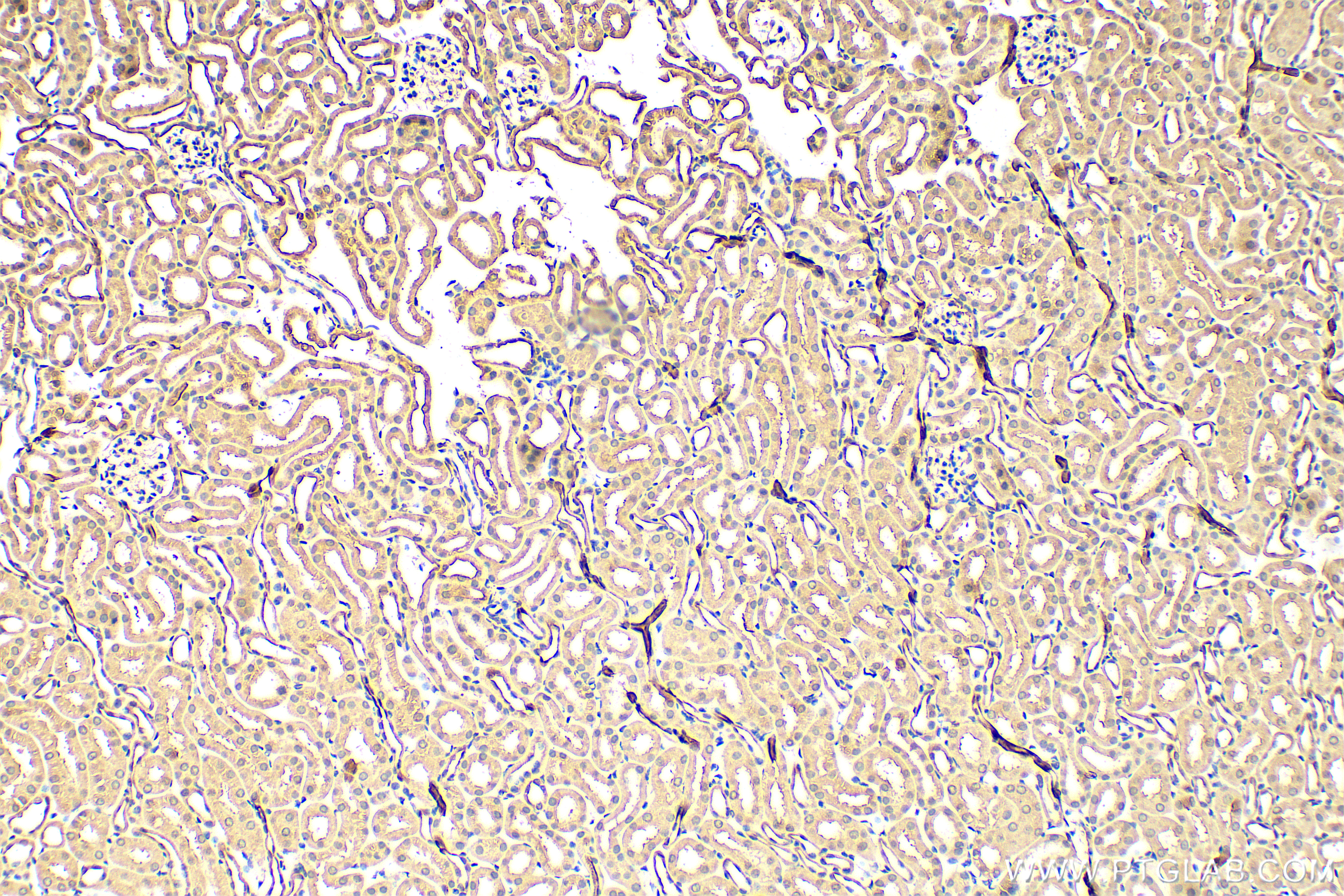 IHC staining of mouse kidney using 26756-1-AP