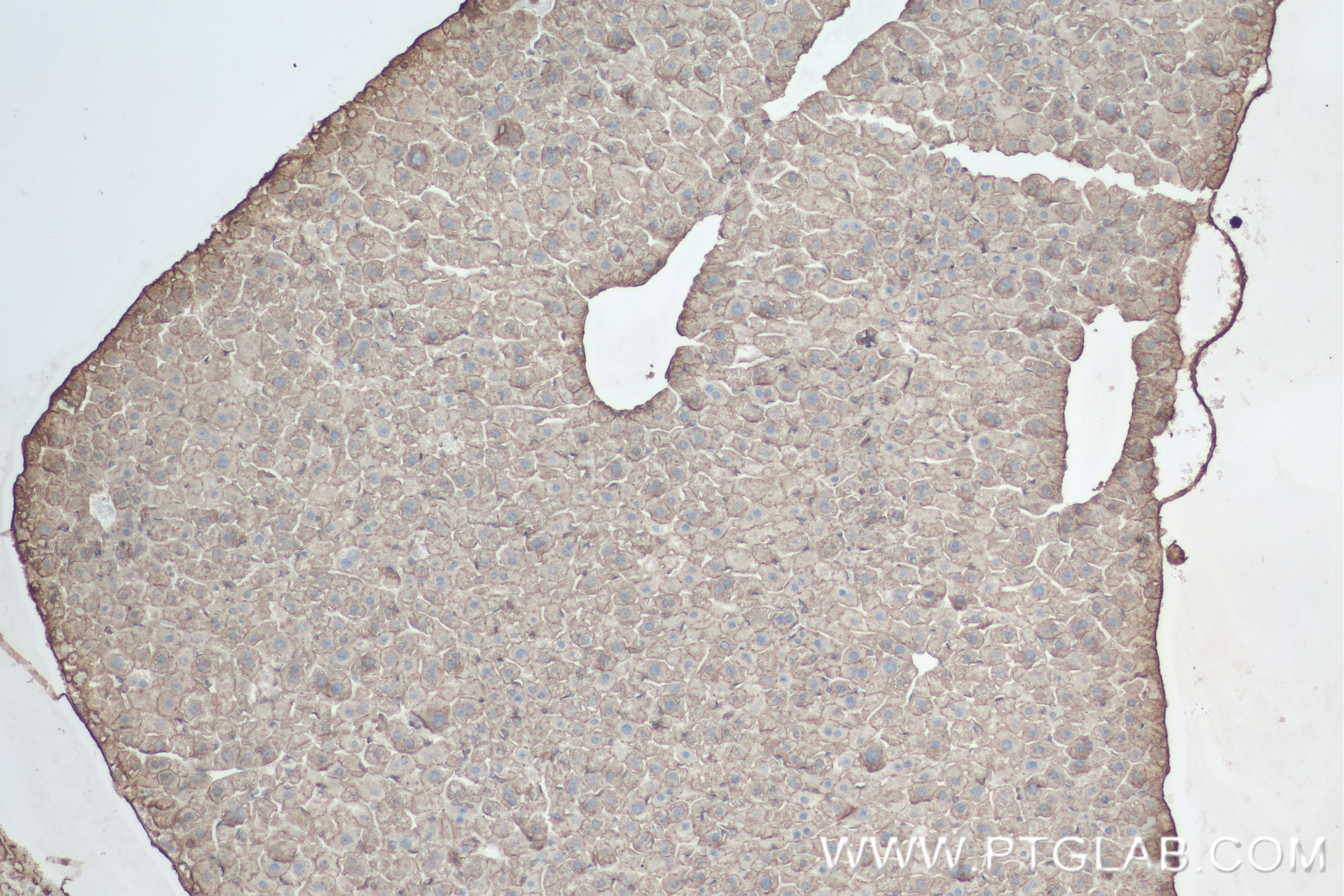 IHC staining of mouse liver using 84655-5-RR