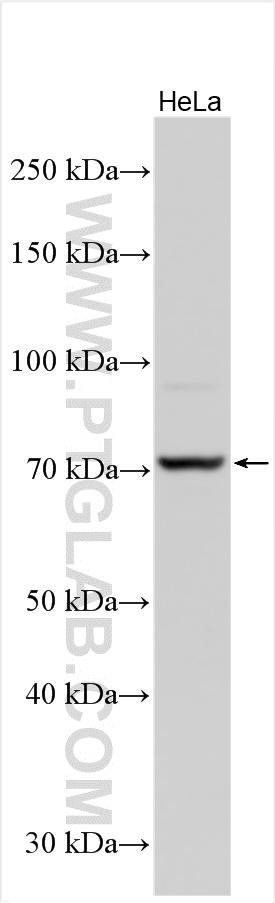 WB analysis using 11073-2-AP