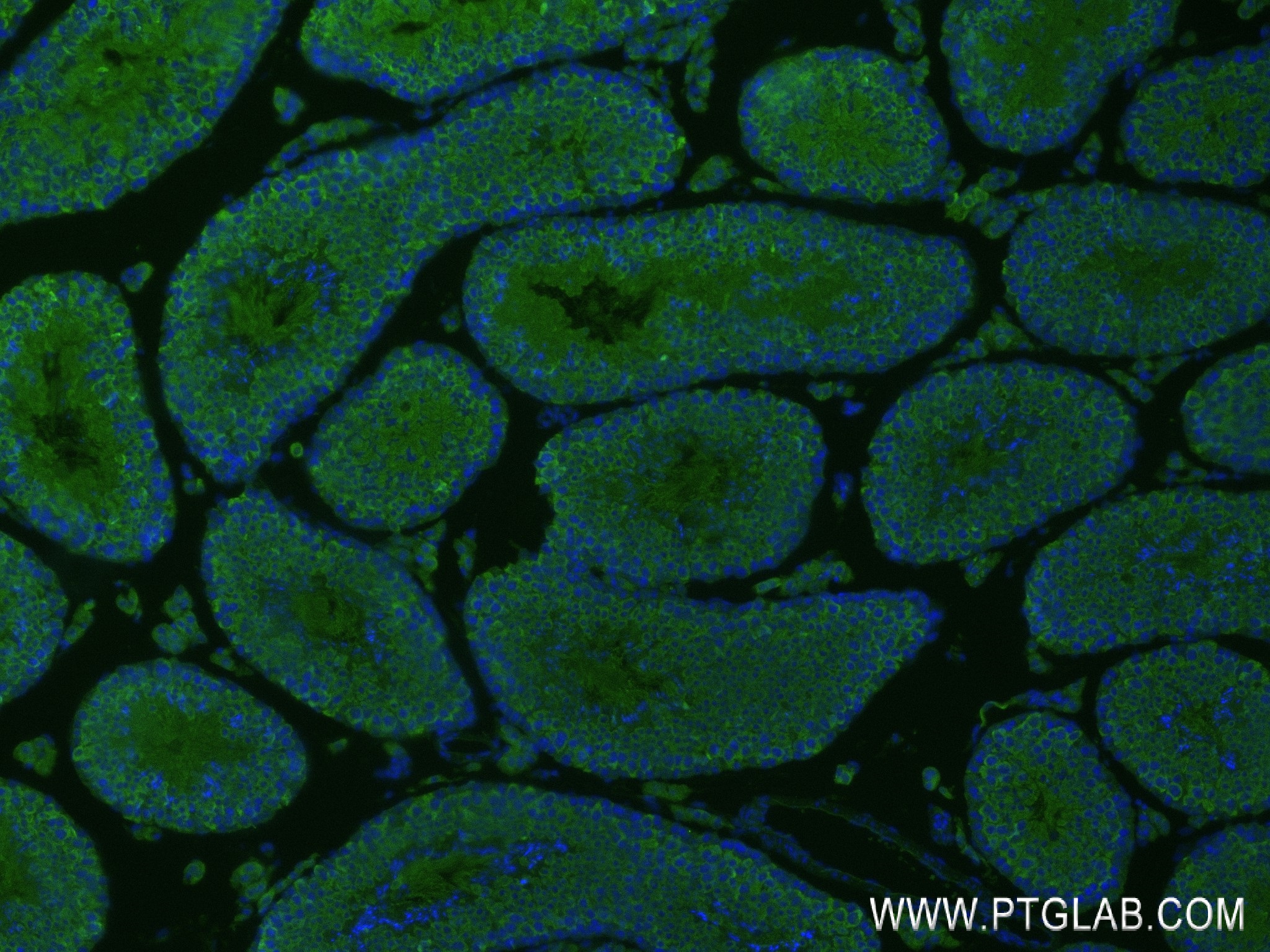 IF Staining of mouse testis using 84904-1-RR (same clone as 84904-1-PBS)