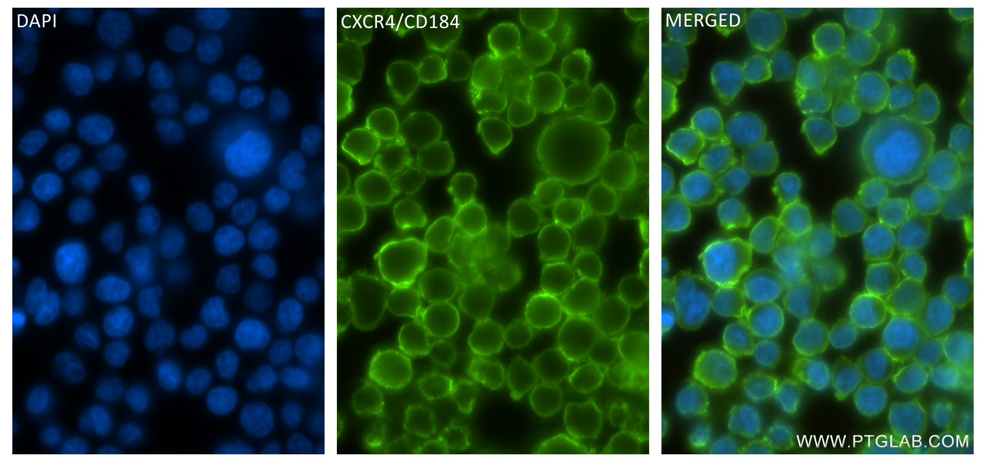 IF Staining of Jurkat using 84904-1-RR (same clone as 84904-1-PBS)