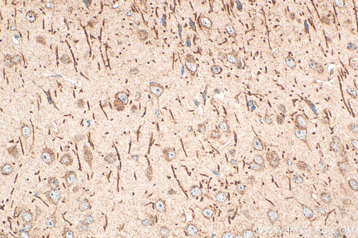 IHC staining of mouse brain using 28239-1-AP