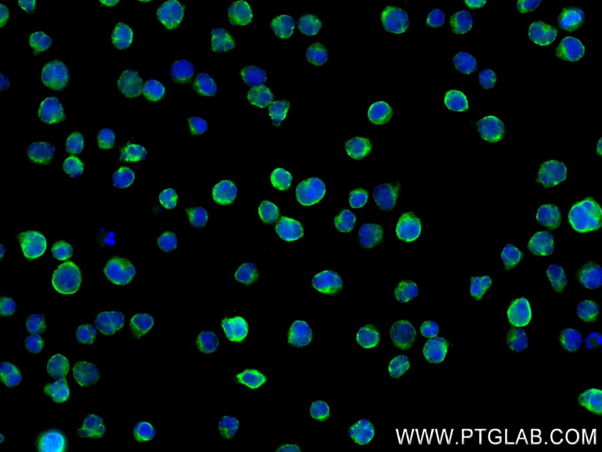 IF Staining of Jurkat using 83927-1-RR