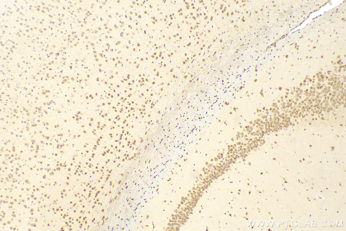 IHC staining of mouse brain using 16513-1-AP