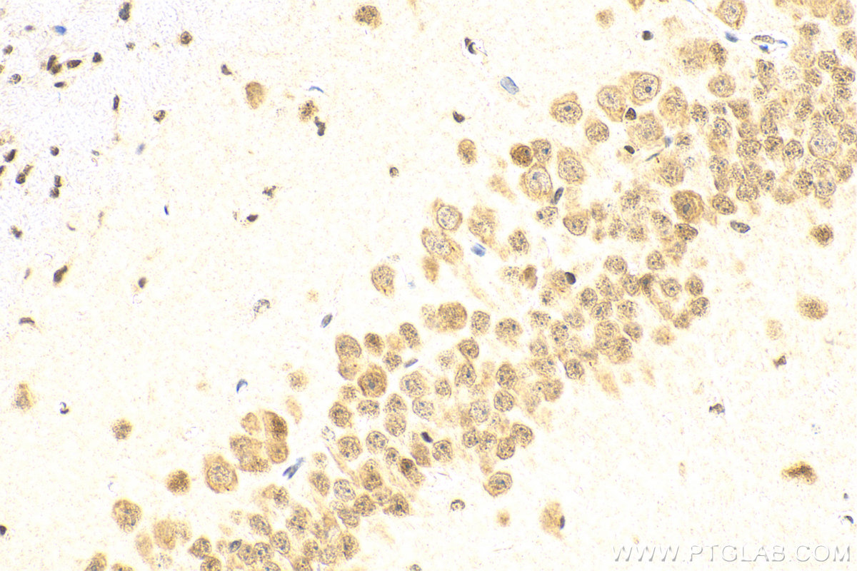 IHC staining of mouse brain using 16513-1-AP