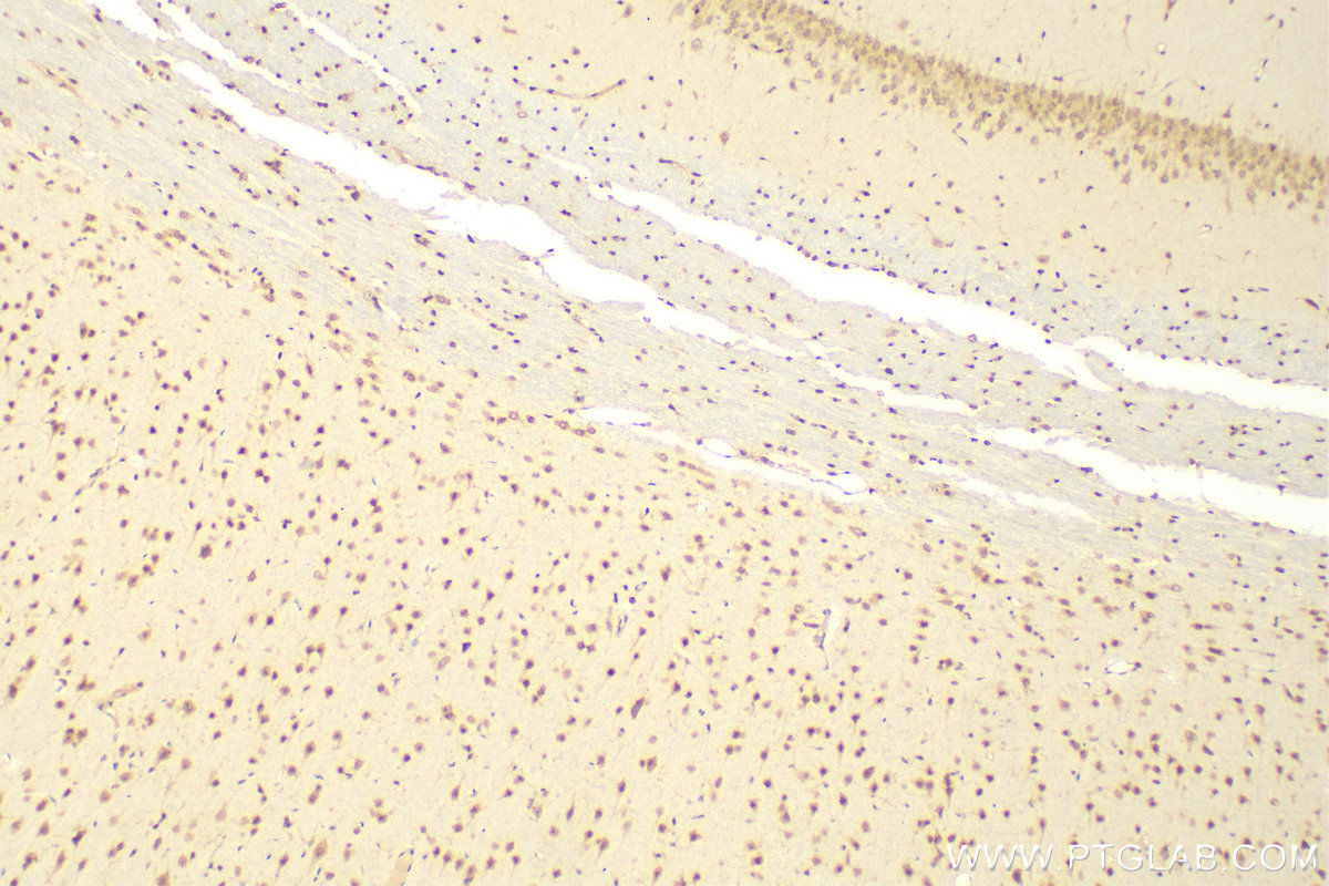 IHC staining of rat brain using 16513-1-AP