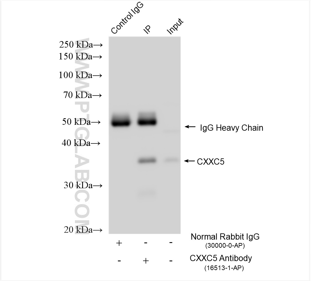 IP experiment of SH-SY5Y using 16513-1-AP