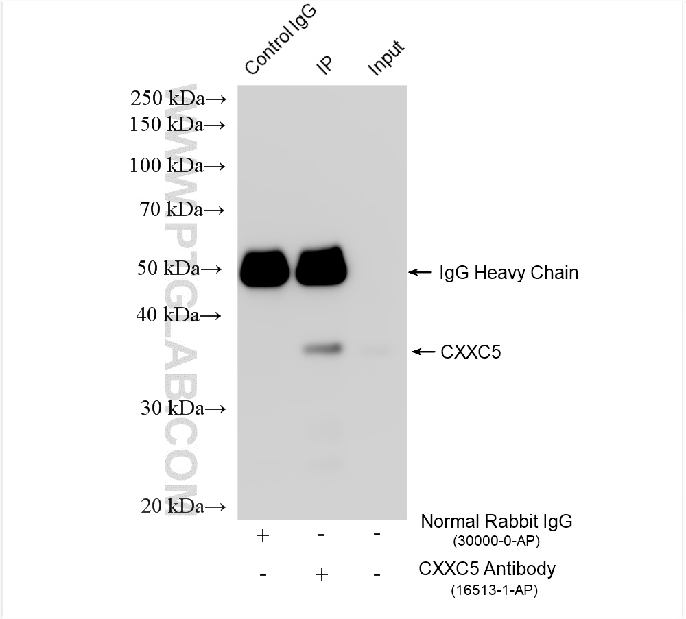 IP experiment of mouse brain using 16513-1-AP