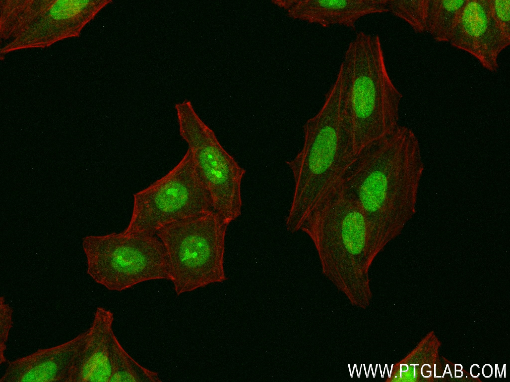 IF Staining of HepG2 using 83940-6-RR