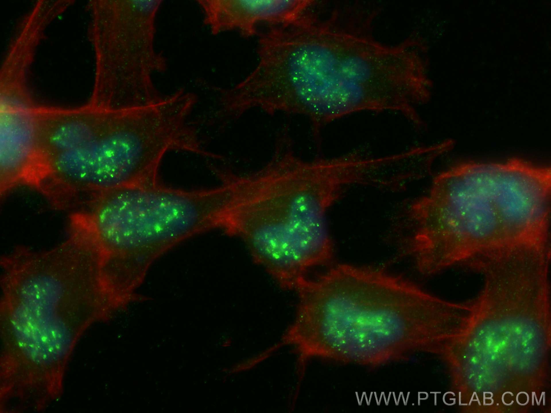 IF Staining of U-251 using 30244-1-AP