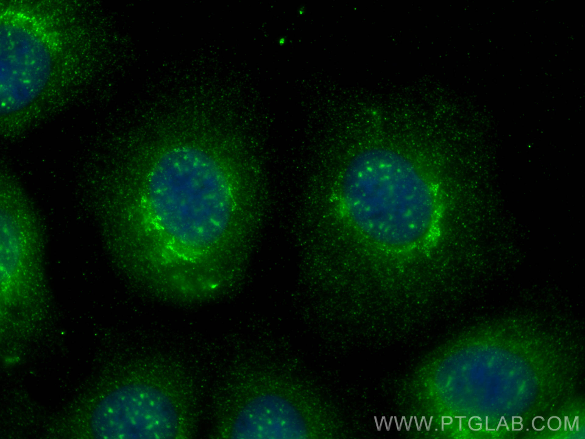 IF Staining of U2OS using 30244-1-AP