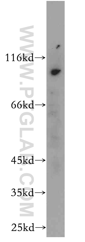 WB analysis of mouse lung using 20837-1-AP