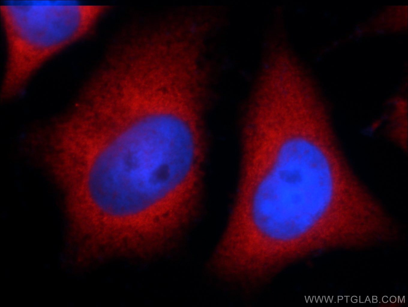 IF Staining of HeLa using 20137-1-AP