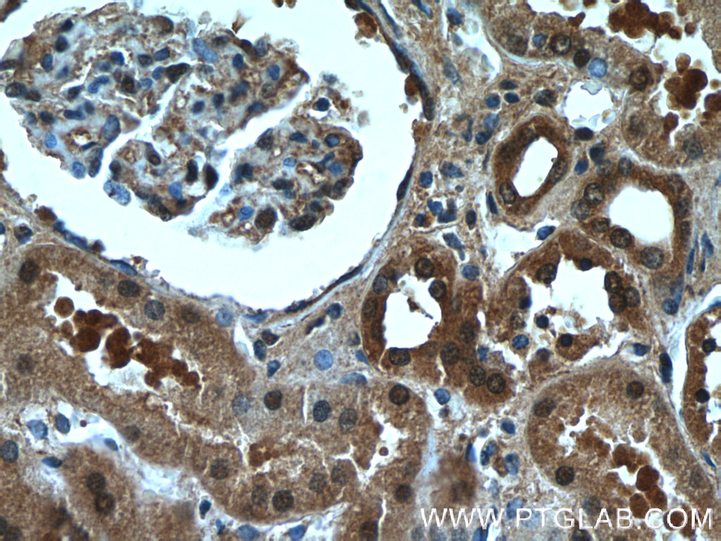 IHC staining of human kidney using 20137-1-AP