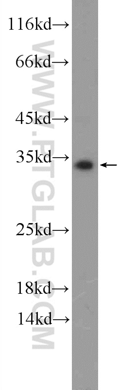 WB analysis of A549 using 20137-1-AP