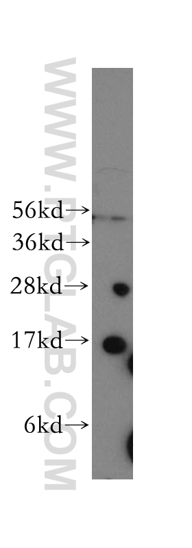 WB analysis of human liver using 12365-1-AP