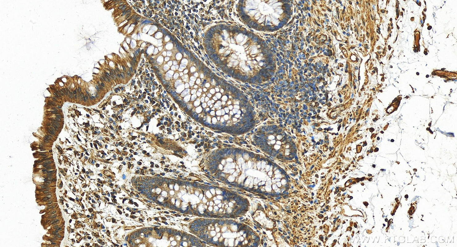 IHC staining of human normal colon using 10894-1-AP