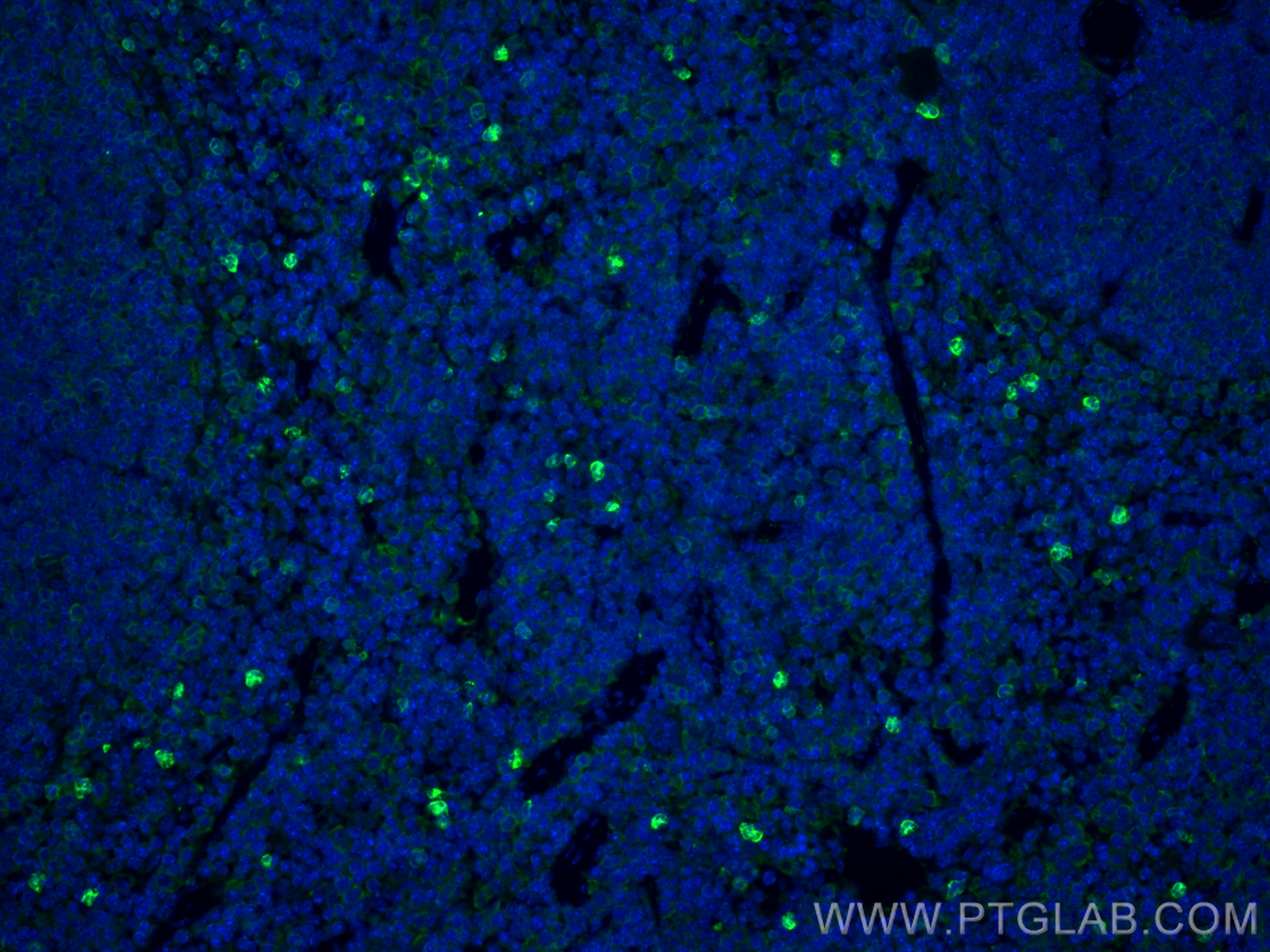 IF Staining of mouse spleen using 19013-1-AP