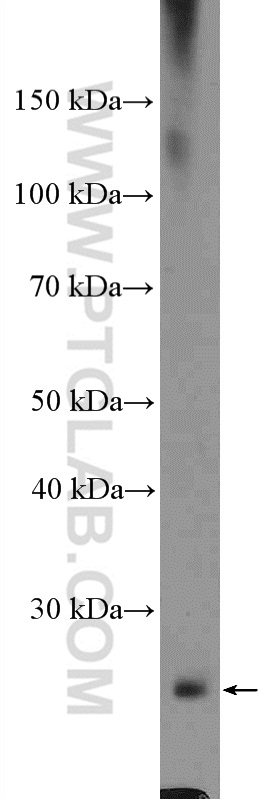 WB analysis of COLO 320 using 26735-1-AP